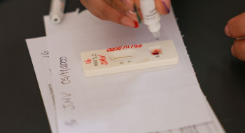 Ação no DF oferece testagem rápida e informação sobre HIV/Aids