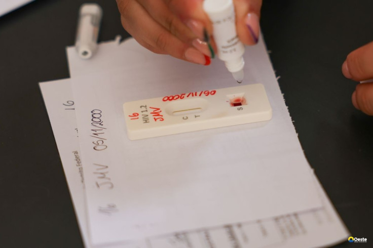 Ação no DF oferece testagem rápida e informação sobre HIV/Aids