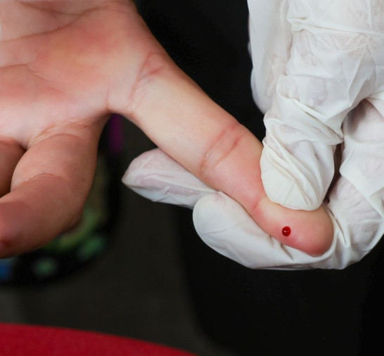 Brasil atinge meta de redução da transmissão vertical de hepatite B