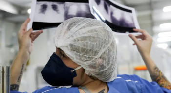 Brasil deve ter 781 mil novos casos de câncer por ano até 2028