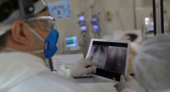 Broncopneumonia: entenda quadro que causou internação de Bolsonaro