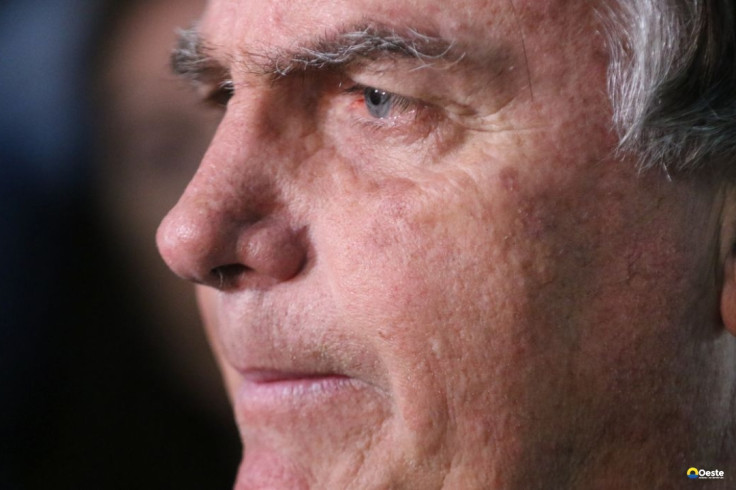 Com crise persistente de soluços, Bolsonaro faz nova cirurgia