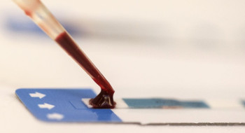 Estudo inédito da Fiocruz pode ampliar prevenção de HIV entre jovens