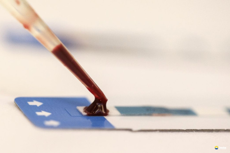 Estudo inédito da Fiocruz pode ampliar prevenção de HIV entre jovens