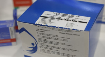 Fiocruz vai ampliar produção de kits diagnósticos para o SUS