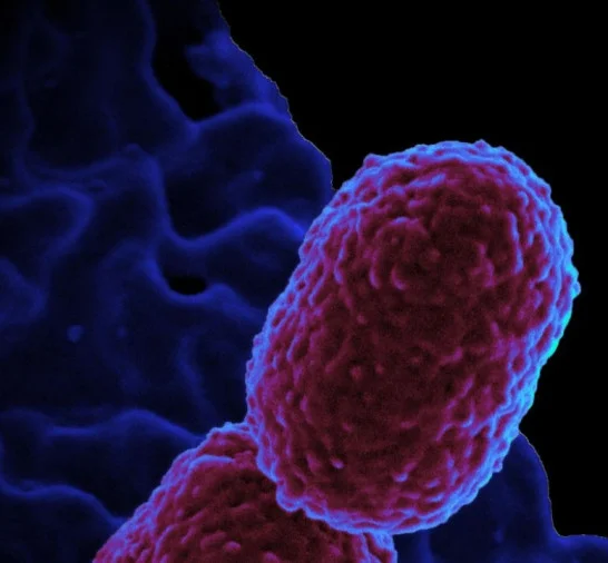 Hospital em Campinas restringe atendimento para conter superbactéria