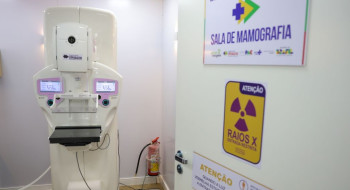 Lei garante mamografia pelo SUS para mulheres a partir dos 40 anos