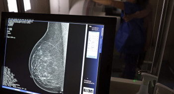 Ministério da Saúde passa a recomendar mamografia a partir dos 40 anos