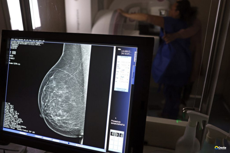 Ministério da Saúde passa a recomendar mamografia a partir dos 40 anos