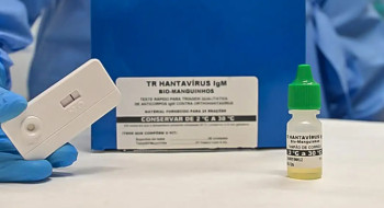 Novo teste faz diagnóstico de hantavirose em 20 minutos