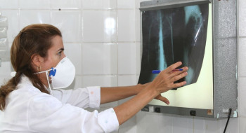 OMS recomenda testes de diagnóstico rápido para erradicar tuberculose