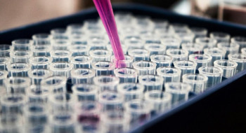 Pesquisas brasileiras avançam no diagnóstico de Alzheimer