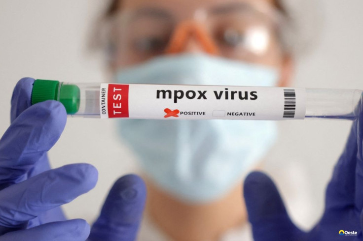 Secretaria de Saúde confirma segundo caso de mpox do grupo lp em SP