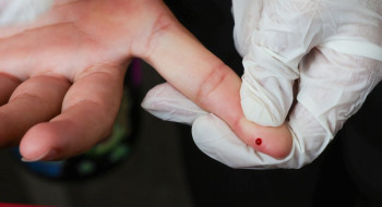 SUS passa a oferecer teste rápido de dengue